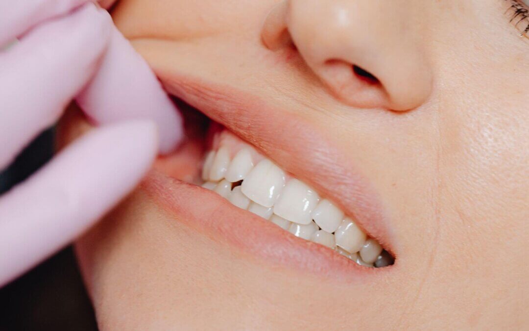 Mobilitatea dentară – Mai poate fi salvat un dinte care se mișcă?
